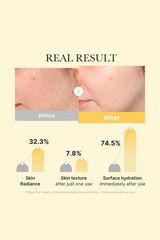 Medicube Kojic Acid Turmeric Brightening Gold Jelly Gel Mask