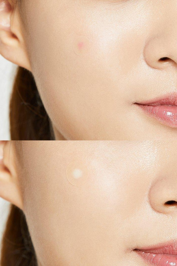 Cosrx Acne Pimple Master 24 Patches
