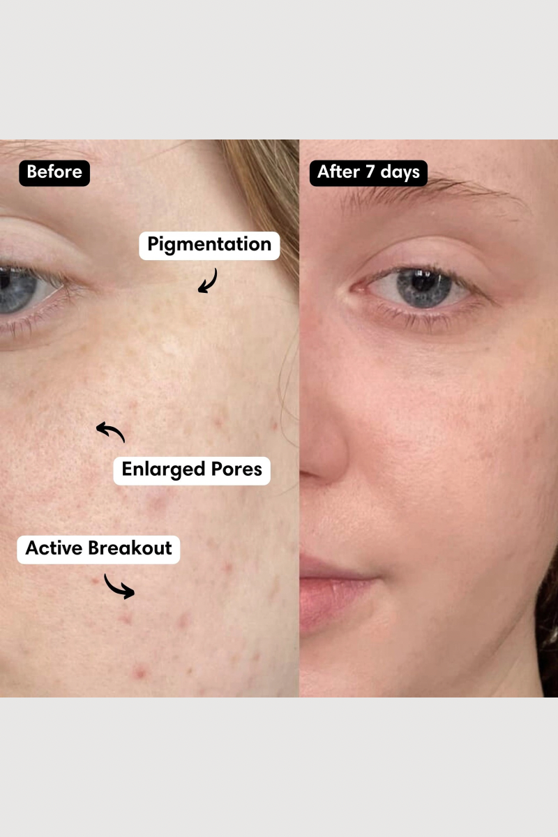 True Luminosity Serum