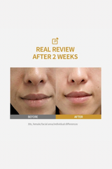 Sungboon Editor Silk Peptide Intensive Lifting Ampoule